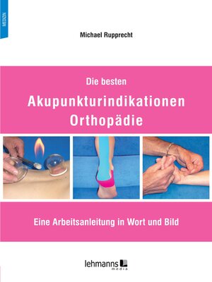 cover image of Die besten Akupunkturindikationen Orthopädie